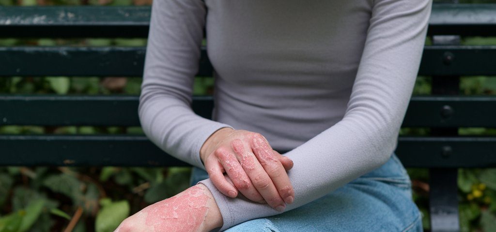 Dupixent lawsuits